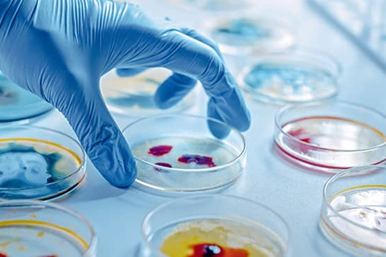 In a microbiology lab, a student  in blue gloves investigates contents of a petri dish as a part of his microbiology assignment help