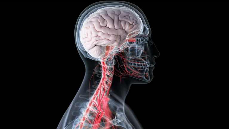 An image showing the human brain and its vascular system, illustrating a neuroscience assignment concept